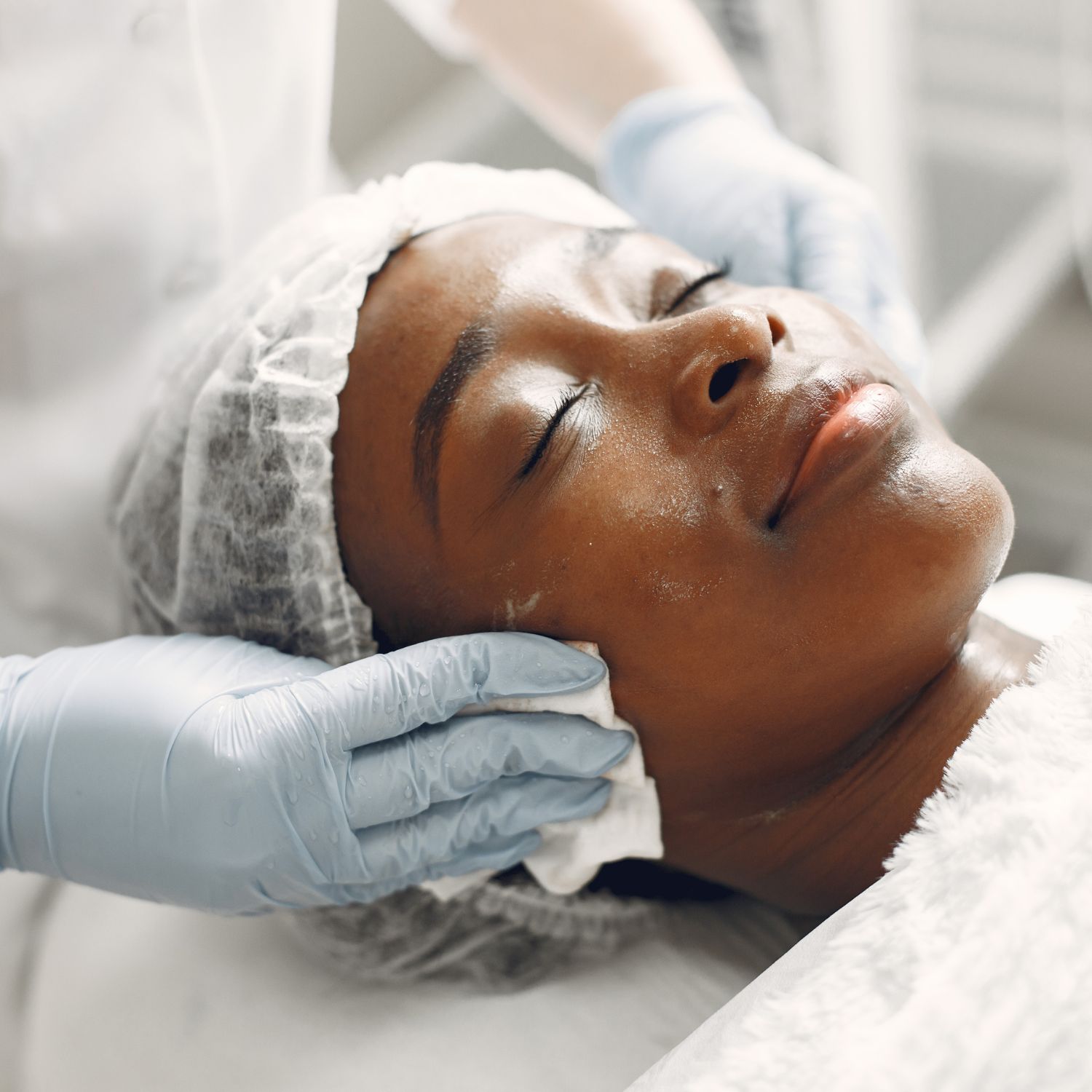 Home All Facial Services in Los Angeles at Miracle Skin Official