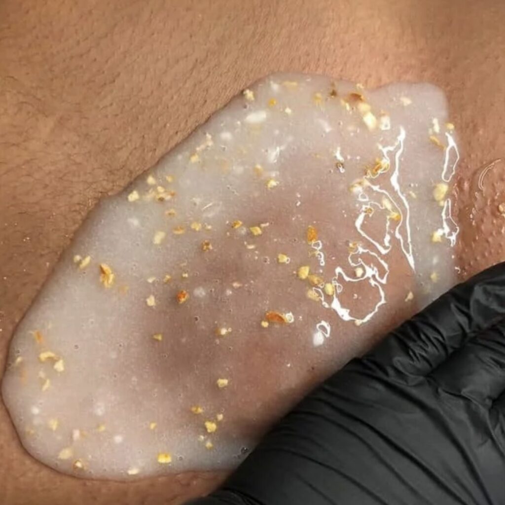 Brazilian Wax Plus Vajacial Treatment in Los Angeles at Miracle Skin Official